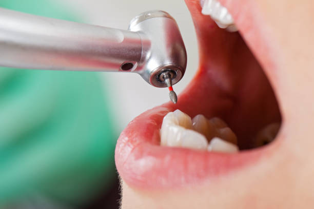 Best Broken or Cracked Tooth Emergency Dentist in Red Lion, PA